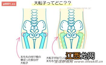 姿势不良导致骨盆凸出变成大屁股？快来试试这３招！