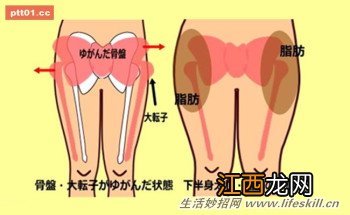 姿势不良导致骨盆凸出变成大屁股？快来试试这３招！