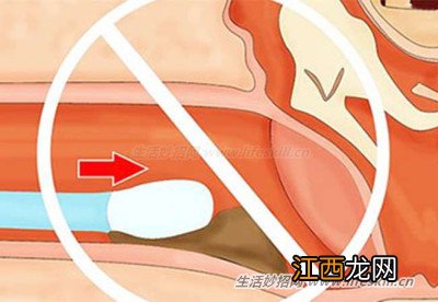 挖耳朵的小知识。看完专家说明，再也不敢乱挖了！