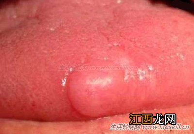 刷牙时看看舌头，这9种状态预示着不同的疾病！