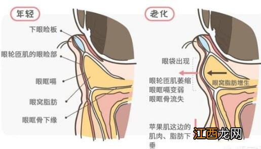 眼霜可以去眼袋的作用吗？