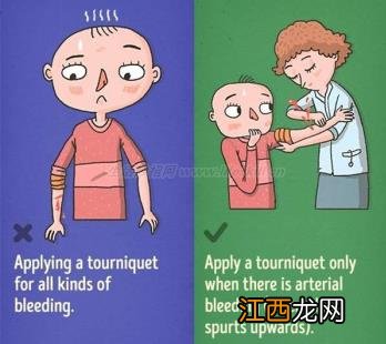 9个错误的急救知识 别让你的善意变成伤害