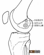 湖北饮食养生汇  饮食养生汇髌骨