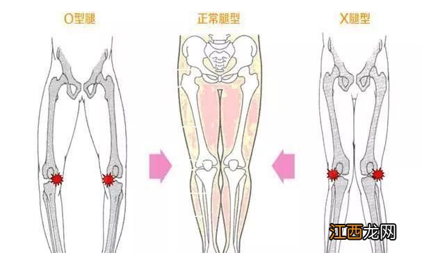 膝盖疼已成为多发病？这些练习让你的膝盖更健康！