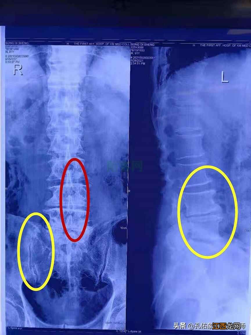 老年人如何健康养生？才能延年益寿，分享4点建议，请收藏