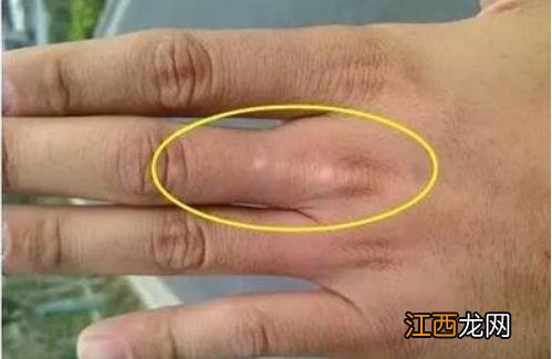 身体出现这4个迹象暗示活不长 口干就是衰老的征兆