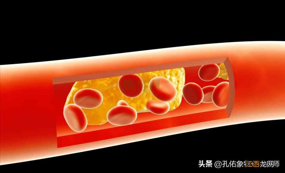 运动是一把双刃剑!老年人对抗衰老,要注意啥?告诉您几个建议