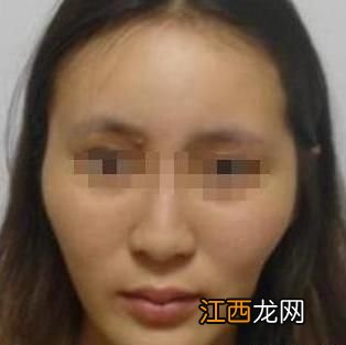 人将要离世的反常表现 女人早死的面相，女人早死的面相