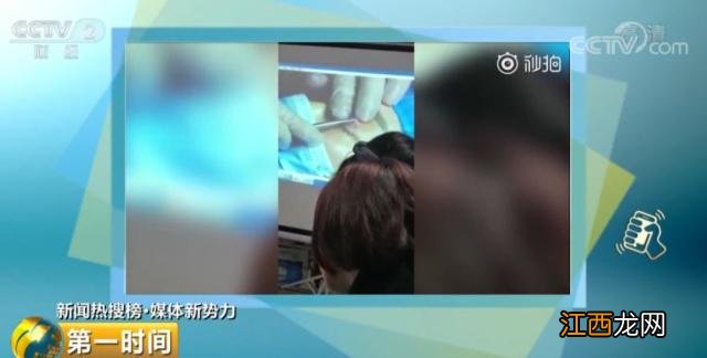 美容机构草率培训黑幕 用鸡翅练习割双眼皮 电视曝光