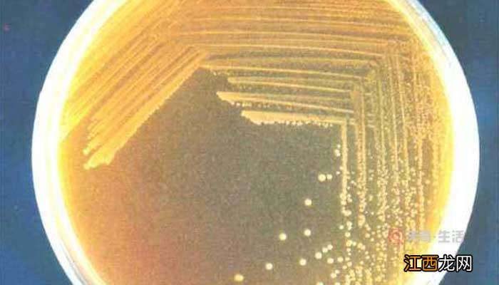 细菌菌落和真菌菌落的区别是什么 细菌菌落和真菌菌落怎么分辨