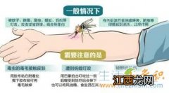 被毒蚊子咬了怎么办蚊子咬了怎么消肿止痒