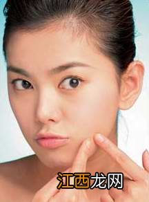 痘痘肌肤的终极攻略——A酸