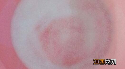 老蒜能腌糖醋大蒜吗