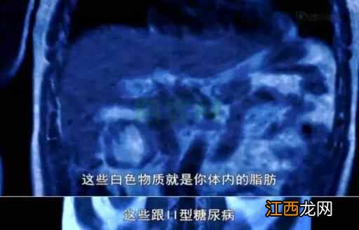 BBC报:中国人迷信的每天1万步,不能养生!跑步也不伤膝盖……