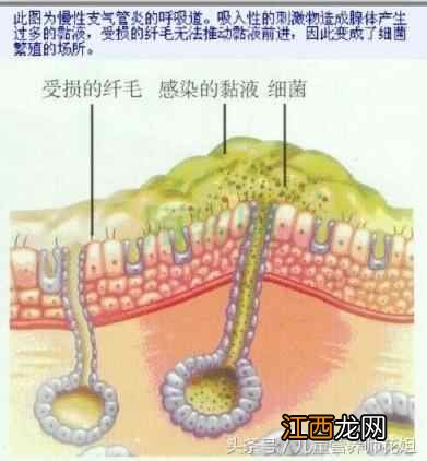 秋季养生 不是你想的那么简单 做好这几步 会好很多 能少生病