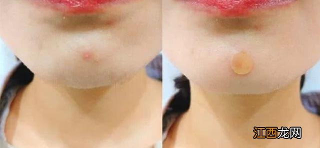 女人熬夜吃什么最好?女人熬夜吃什么最好,这些你知道几点?