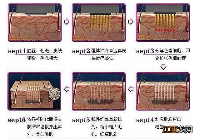 脸上出现红血丝是怎么回事？