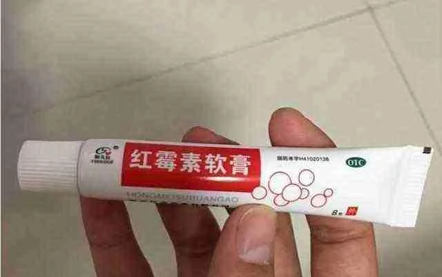 红霉素软膏祛斑方法