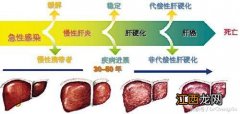 肝硬化腹水吃什么药能彻底除根？肝腹水不能吃什么药，看完自然会了解