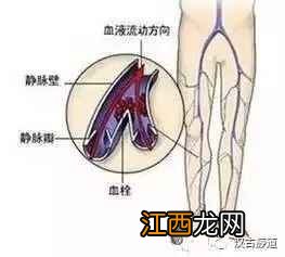 全身经络疏通最快方法是什么 疏通经络最有效的方法