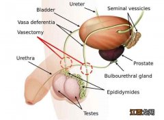 为什么医院不提倡男性结扎 医院不愿意男性结扎的原因