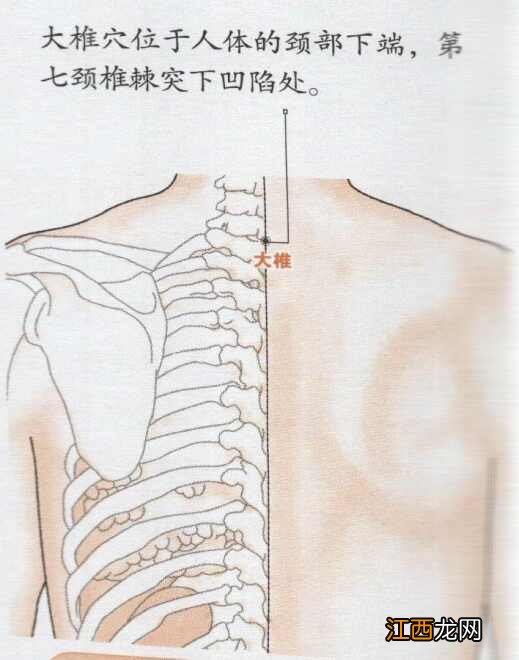 大椎穴位位置图 大椎穴位在哪