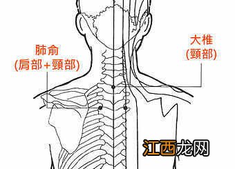 大椎穴位位置图 大椎穴位在哪