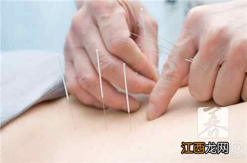 针灸后有什么好转反应 针灸后的最佳好转反应