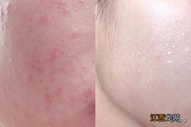 吃什么能够美白皮肤,吃什么皮肤越吃越白,试看这篇文章