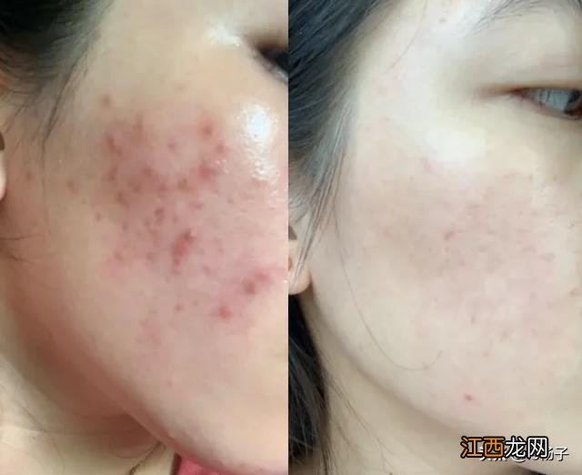 吃什么能够美白皮肤,吃什么皮肤越吃越白,试看这篇文章