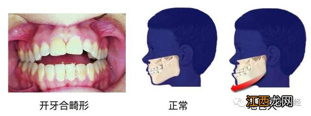 标准舌片是什么样的,压舌片是什么,此文已帮助很多人