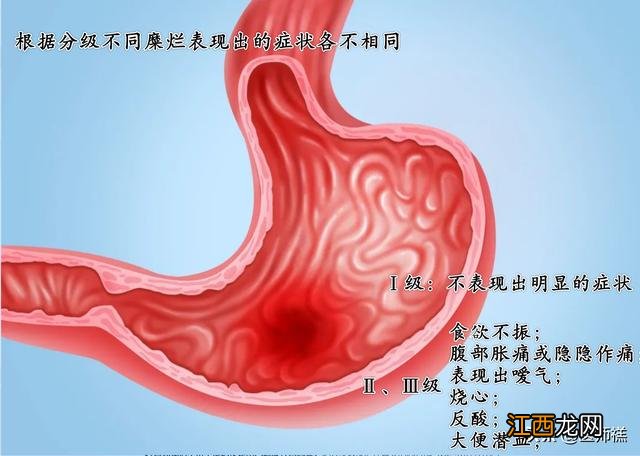 鸡蛋煮熟后用醋泡 泡鸡蛋用什么醋