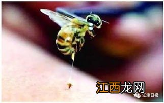 被蜜蜂蛰有什么办法 被蜜蜂蛰了怎么止痛止痒