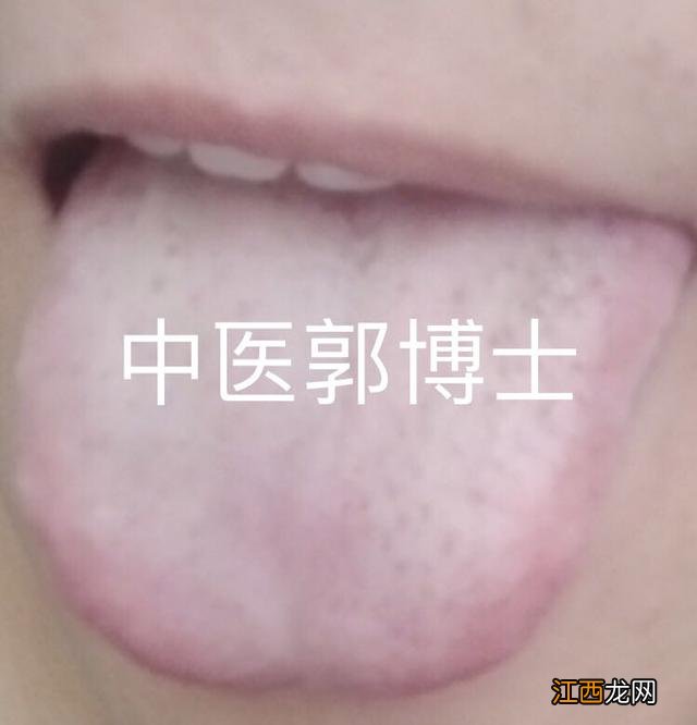 上夜班吃什么药 上夜班熬夜吃什么药