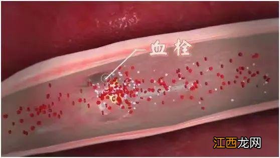 鸡蛋可以和哪些菜一起炒 一个鸡蛋能做什么菜