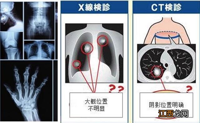 吃什么东西排辐射 吃什么可以排除电磁辐射