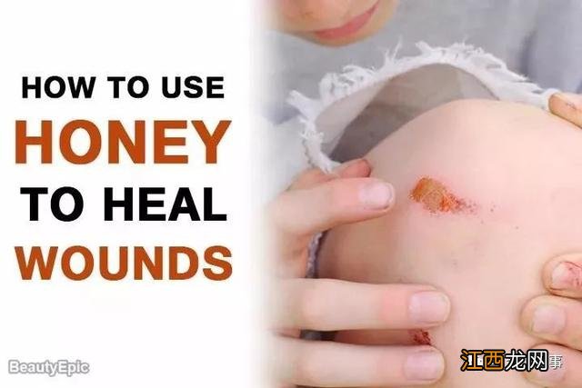 蜂蜜加白醋怎么配比喝 蜂蜜加白醋用什么白醋好