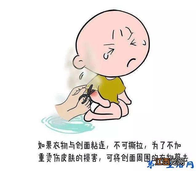 烫伤后怎么急救?