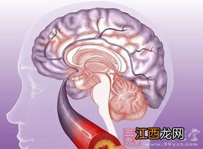 脑血栓哪些水果不能吃？脑血栓忌口表，教你几招，快来学