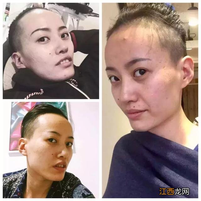 河里的鱼林为什么出现红斑?鱼有红斑图片,学起来简单又实用