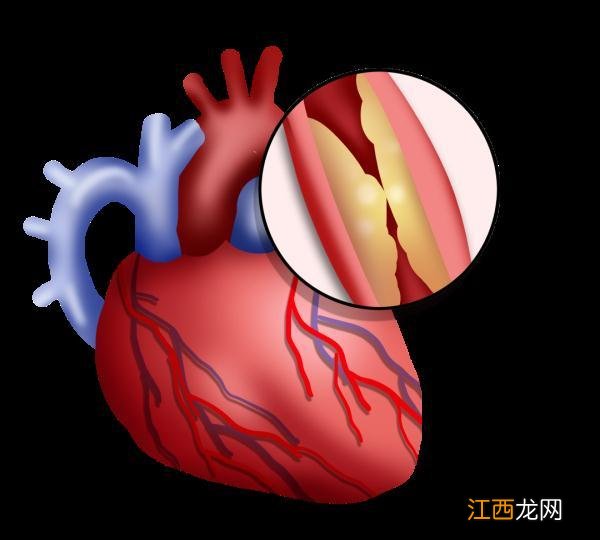 梦见自己大腿流血？血瘤是癌初期吗，推荐大家收藏