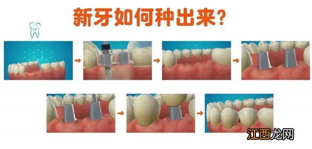 老年人没有牙齿怎么吃东西？老年人牙齿老化的表现，一波科普涨知识