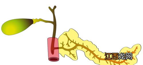 胆囊炎吃消炎利胆片 胆囊切除后应该吃什么药