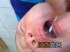 小孩子口腔溃疡吃什么 小孩口腔溃疡吃什么食物比较好