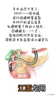 胆囊切除15天能吃什么 胆囊切除5到10天的饮食