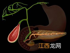 急性胆囊炎吃什么好 急性胆囊炎能吃什么食物好