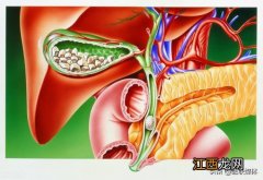 急性胆囊炎吃什么好 急性胆囊炎能吃什么食物好