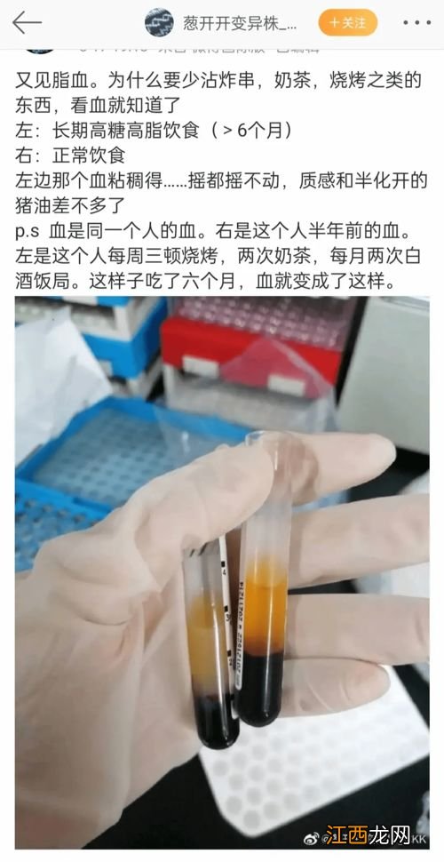 小孩吃什么可以明目 吃什么食物对眼睛好又明目