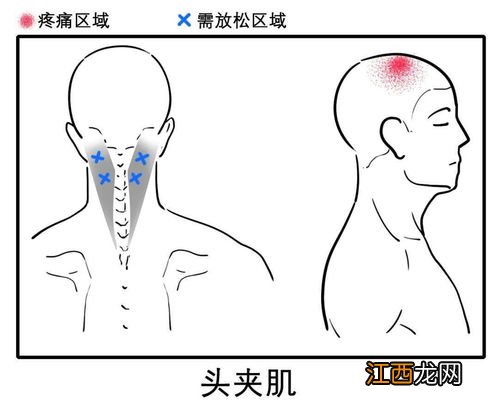 吃什么可以缓解头疼 头痛吃什么食物可以缓解