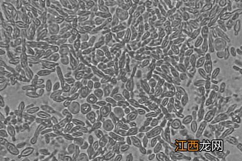 酵母菌的繁殖方式，分别介绍芽殖、裂殖、芽裂、孢子繁殖